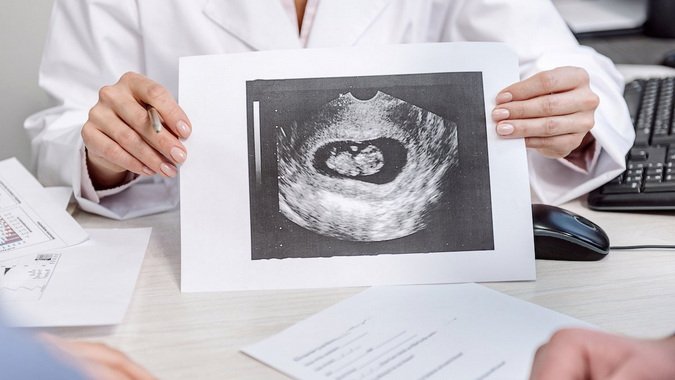 Результат УЗИ Результат УЗИ